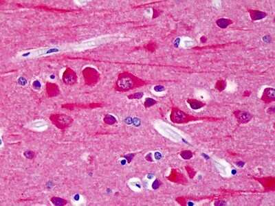 Immunohistochemistry-Paraffin: CaMKIIN2 [p Thr286] Antibody [NBP1-50259] - Analysis of anti-CAMK2 antibody with human brain, cortex at dilution 1:200.